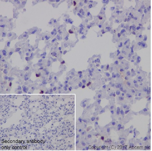 Immunohistochemistry (Formalin/PFA-fixed paraffin-embedded sections) - Anti-p21 antibody [EPR18021] - BSA and Azide free (ab232512), expandable thumbnail