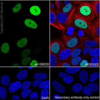 Immunocytochemistry/ Immunofluorescence - Anti-p21 antibody [EPR362] - BSA and Azide free (AB218311)