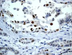 Immunohistochemistry (Formalin/PFA-fixed paraffin-embedded sections) - Anti-p21 antibody [EPR362] - BSA and Azide free (AB218311)
