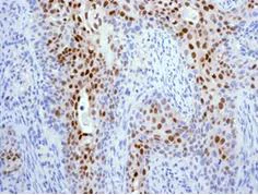 Immunohistochemistry (Formalin/PFA-fixed paraffin-embedded sections) - Anti-p21 antibody [EPR362] - BSA and Azide free (AB218311)