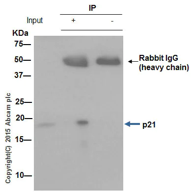 Immunoprecipitation - Anti-p21 antibody [EPR362] - BSA and Azide free (AB218311)