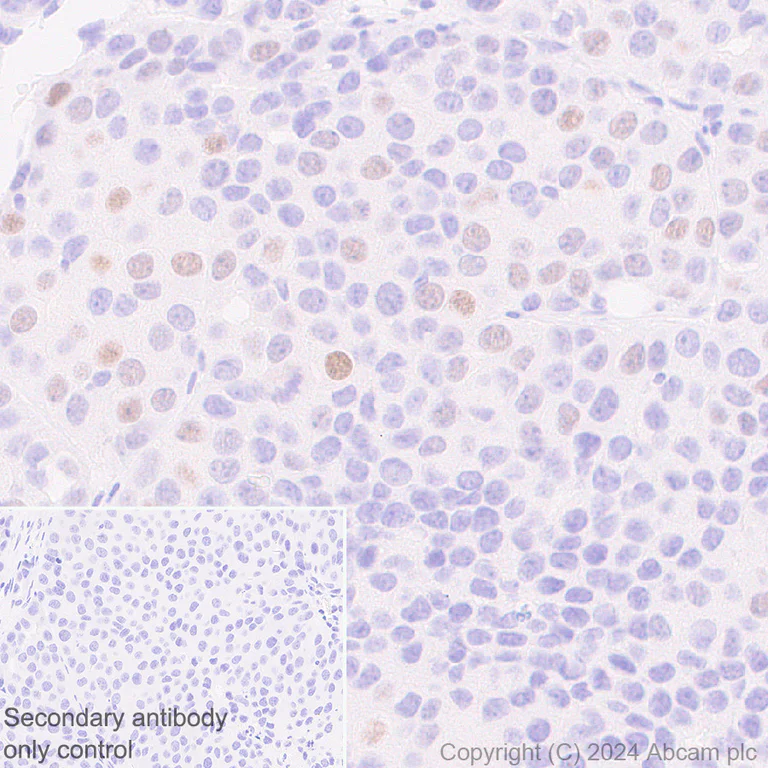 Immunohistochemistry (Formalin/PFA-fixed paraffin-embedded sections) - Anti-p21 antibody [HUGO291] (AB107099)