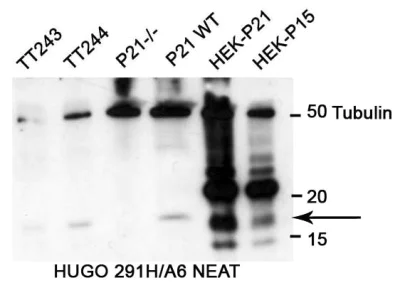 Anti-p21 antibody [HUGO291] (ab107099) | Abcam