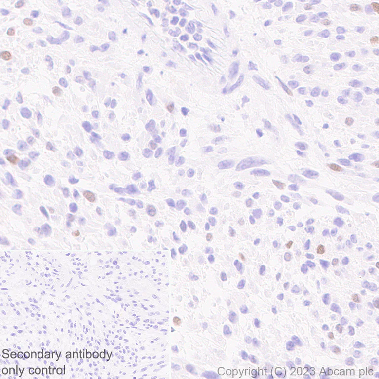 Immunohistochemistry (Formalin/PFA-fixed paraffin-embedded sections) - Anti-p21 antibody [HUGO291] - BSA and Azide free (AB317039)