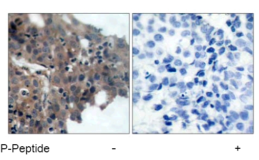 Immunohistochemistry (Formalin/PFA-fixed paraffin-embedded sections) - Anti-p21 (phospho T145) antibody (AB47300)