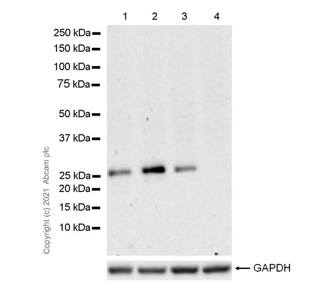 Western blot - Anti-p27 KIP 1 antibody [57/Kip1/p27] (AB280580), expandable thumbnail