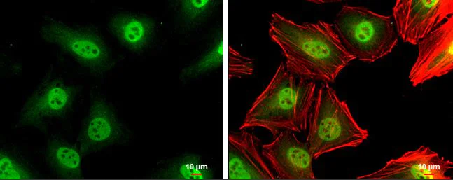 Immunocytochemistry/ Immunofluorescence - Anti-p27 KIP 1 antibody (AB137736)