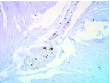 Immunohistochemistry (Formalin/PFA-fixed paraffin-embedded sections) - Anti-p27 KIP 1 antibody (AB137736)