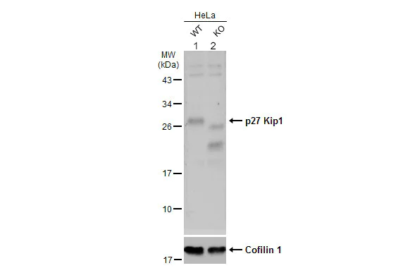 Western blot - Anti-p27 KIP 1 antibody (AB137736)