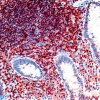 Immunohistochemistry (Formalin/PFA-fixed paraffin-embedded sections) - Anti-p27 KIP 1 antibody [DCS-72.F6] (AB3928)