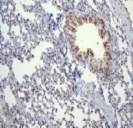 Immunohistochemistry (Formalin/PFA-fixed paraffin-embedded sections) - Anti-p27 KIP 1 antibody [EPFHCR16] (AB92741), expandable thumbnail