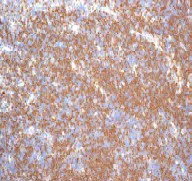 Immunohistochemistry (Formalin/PFA-fixed paraffin-embedded sections) - Anti-p27 KIP 1 antibody [EPFHCR16] (AB92741)