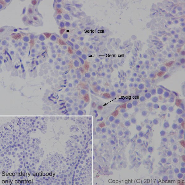 Immunohistochemistry (Formalin/PFA-fixed paraffin-embedded sections) - Anti-p27 KIP 1 antibody [EPFHCR16] (AB92741), expandable thumbnail
