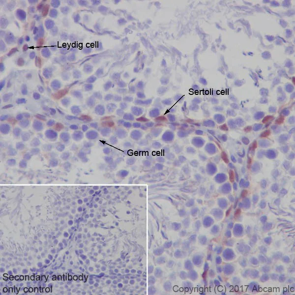 Immunohistochemistry (Formalin/PFA-fixed paraffin-embedded sections) - Anti-p27 KIP 1 antibody [EPFHCR16] (AB92741)