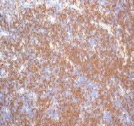 Immunohistochemistry (Formalin/PFA-fixed paraffin-embedded sections) - Anti-p27 KIP 1 antibody [EPFHCR16] - BSA and Azide free (ab247597), expandable thumbnail