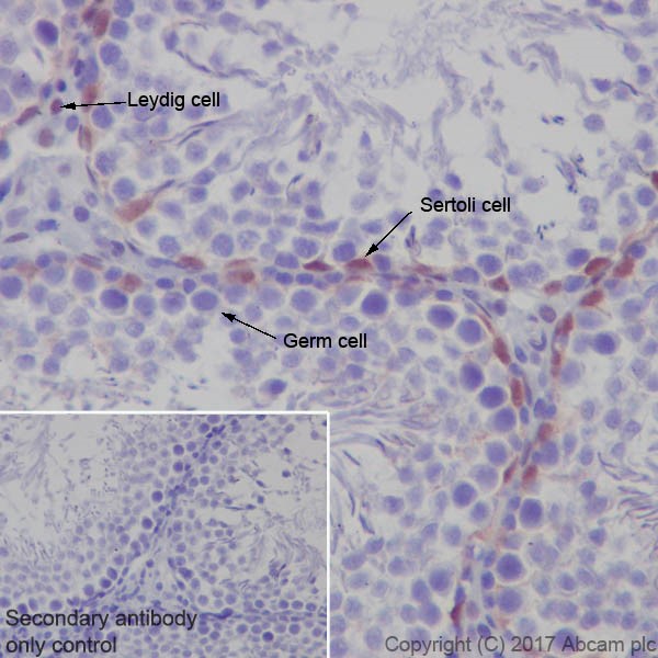 Immunohistochemistry (Formalin/PFA-fixed paraffin-embedded sections) - Anti-p27 KIP 1 antibody [EPFHCR16] - BSA and Azide free (AB247597), expandable thumbnail