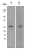 Western blot - Anti-p27 KIP 1 antibody [EPFHCR16a] - BSA and Azide free (AB247947), expandable thumbnail