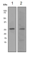 Western blot - Anti-p27 KIP 1 antibody [EPFHCR16a] - BSA and Azide free (AB247947)