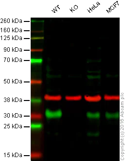 Western blot - Anti-p27 KIP 1 antibody [EPFHCR16a] - BSA and Azide free (AB247947)