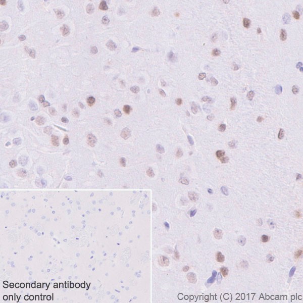 Immunohistochemistry (Formalin/PFA-fixed paraffin-embedded sections) - Anti-p27 KIP 1 antibody [EPR18388-138] (ab190851), expandable thumbnail