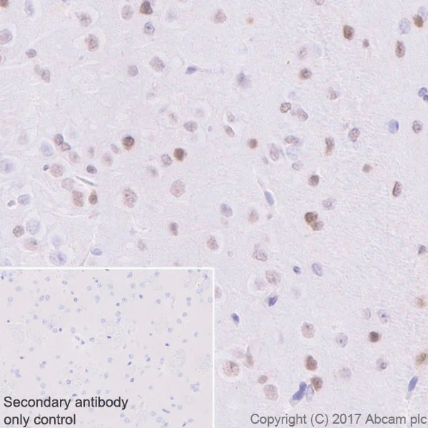 Immunohistochemistry (Formalin/PFA-fixed paraffin-embedded sections) - Anti-p27 KIP 1 antibody [EPR18388-138] (AB190851)