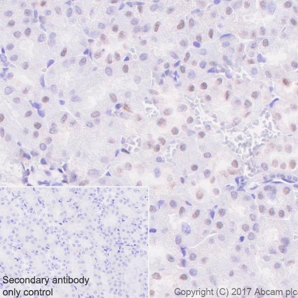 Immunohistochemistry (Formalin/PFA-fixed paraffin-embedded sections) - Anti-p27 KIP 1 antibody [EPR18388-138] (AB190851), expandable thumbnail