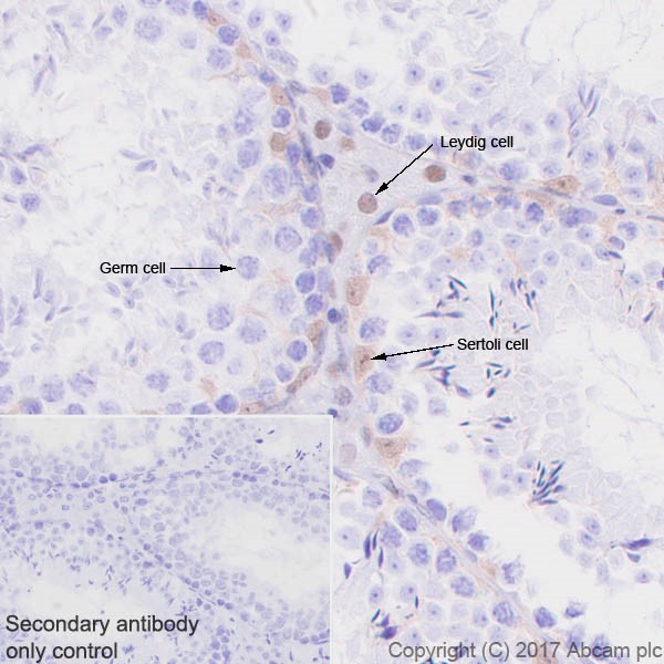 Immunohistochemistry (Formalin/PFA-fixed paraffin-embedded sections) - Anti-p27 KIP 1 antibody [EPR18388-138] (AB190851), expandable thumbnail