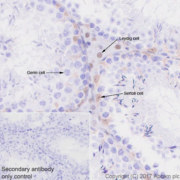 Immunohistochemistry (Formalin/PFA-fixed paraffin-embedded sections) - Anti-p27 KIP 1 antibody [EPR18388-138] (AB190851)