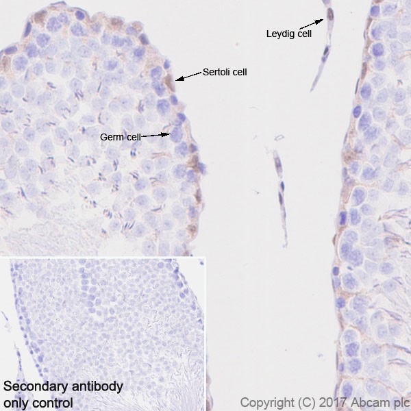 Immunohistochemistry (Formalin/PFA-fixed paraffin-embedded sections) - Anti-p27 KIP 1 antibody [EPR18388-138] (ab190851), expandable thumbnail