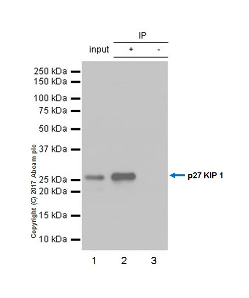 Immunoprecipitation - Anti-p27 KIP 1 antibody [EPR18388-138] (AB190851), expandable thumbnail