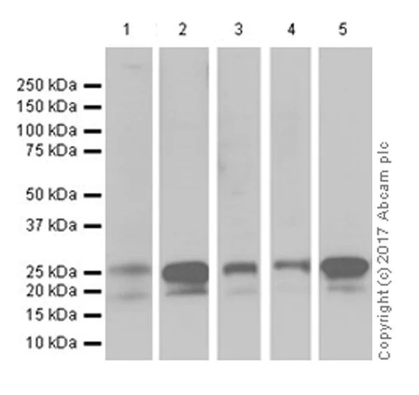 Western blot - Anti-p27 KIP 1 antibody [EPR18388-138] (AB190851)