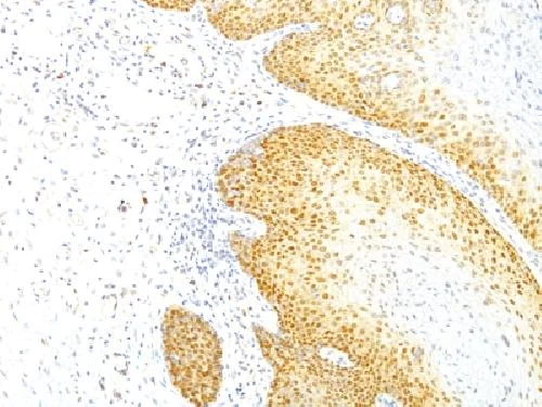 Immunohistochemistry (Formalin/PFA-fixed paraffin-embedded sections) - Anti-p27 KIP 1 antibody [KIP1/769] - BSA and Azide free (AB212252)