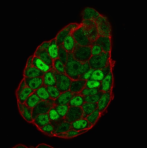 Immunocytochemistry - Anti-p27 KIP 1 antibody [SX53G8] (AB193379), expandable thumbnail
