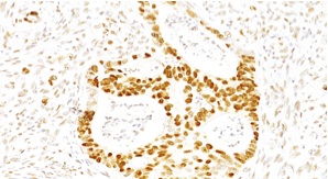 Immunohistochemistry (Formalin/PFA-fixed paraffin-embedded sections) - Anti-p27 KIP 1 antibody [SX53G8] (AB193379), expandable thumbnail