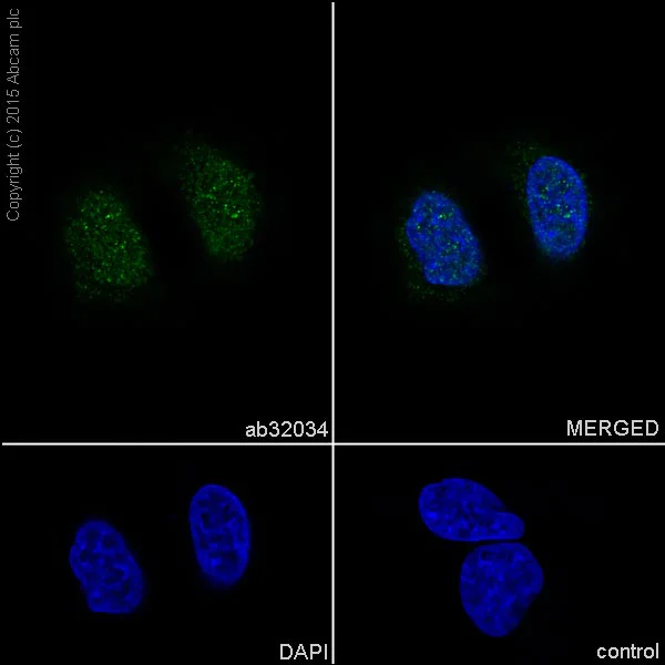 Immunocytochemistry/ Immunofluorescence - Anti-p27 KIP 1 antibody [Y236] (AB32034)