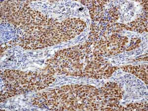 Immunohistochemistry (Formalin/PFA-fixed paraffin-embedded sections) - Anti-p27 KIP 1 antibody [Y236] - BSA and Azide free (AB206927)