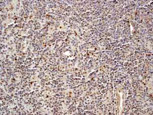 Immunohistochemistry (Formalin/PFA-fixed paraffin-embedded sections) - Anti-p27 KIP 1 antibody [Y236] - BSA and Azide free (AB206927)