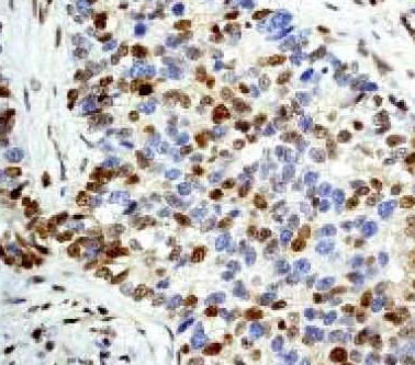 Immunohistochemistry (Formalin/PFA-fixed paraffin-embedded sections) - Anti-p27 KIP 1 antibody [Y236] - BSA and Azide free (AB206927)