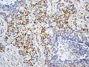 Immunohistochemistry (Formalin/PFA-fixed paraffin-embedded sections) - Anti-p27 KIP 1 antibody [Y236] - BSA and Azide free (AB206927)