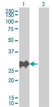 Western blot - p27 KIP 1 overexpression 293T lysate (whole cell) (AB94316), expandable thumbnail