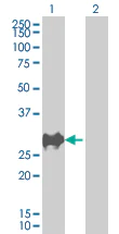 Western blot - p27 KIP 1 overexpression 293T lysate (whole cell) (AB94316)