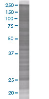 SDS-PAGE - p27 KIP 1 overexpression 293T lysate (whole cell) (AB94317), expandable thumbnail