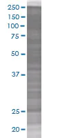 SDS-PAGE - p27 KIP 1 overexpression 293T lysate (whole cell) (AB94317)