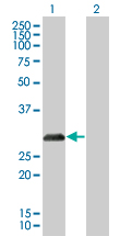 Western blot - p27 KIP 1 overexpression 293T lysate (whole cell) (AB94317), expandable thumbnail
