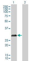 Western blot - p27 KIP 1 overexpression 293T lysate (whole cell) (AB94317)