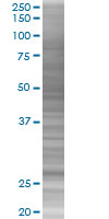 p27 KIP 1 overexpression 293T lysate (whole cell)