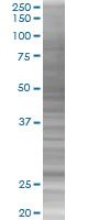 SDS-PAGE - p27 KIP 1 overexpression 293T lysate (whole cell) (AB94318)