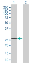 Western blot - p27 KIP 1 overexpression 293T lysate (whole cell) (AB94318)