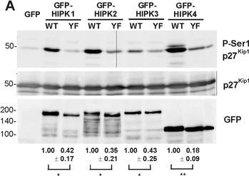 Western blot - Anti-p27 KIP 1 (phospho S10) antibody [EP233(2)Y] (AB62364)