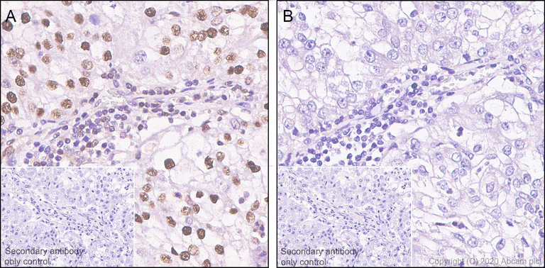 Immunohistochemistry (Formalin/PFA-fixed paraffin-embedded sections) - Anti-p27 KIP 1 (phospho S10) antibody [EP233(2)Y] - BSA and Azide free (AB228877)